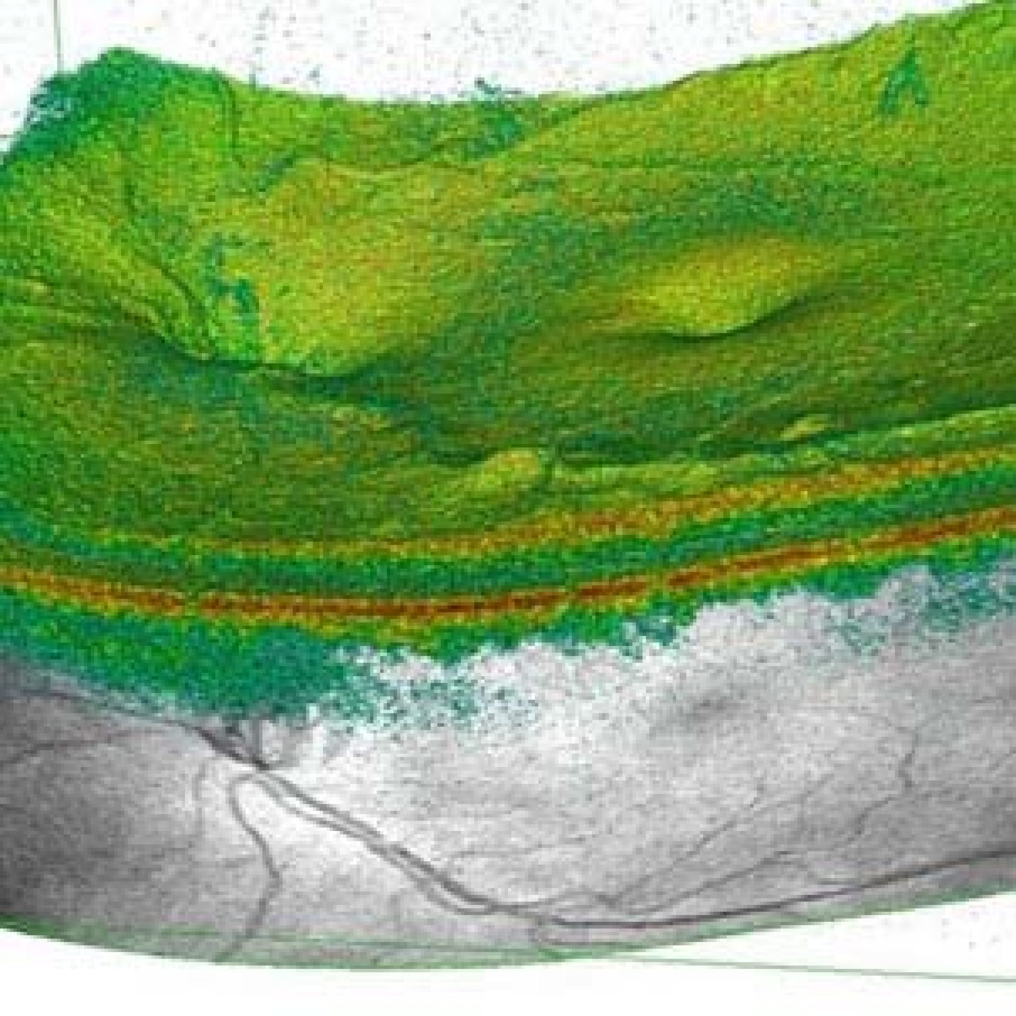 OCT Optischer Kohärenztomograph Bergman Clinics Medical EyeCare