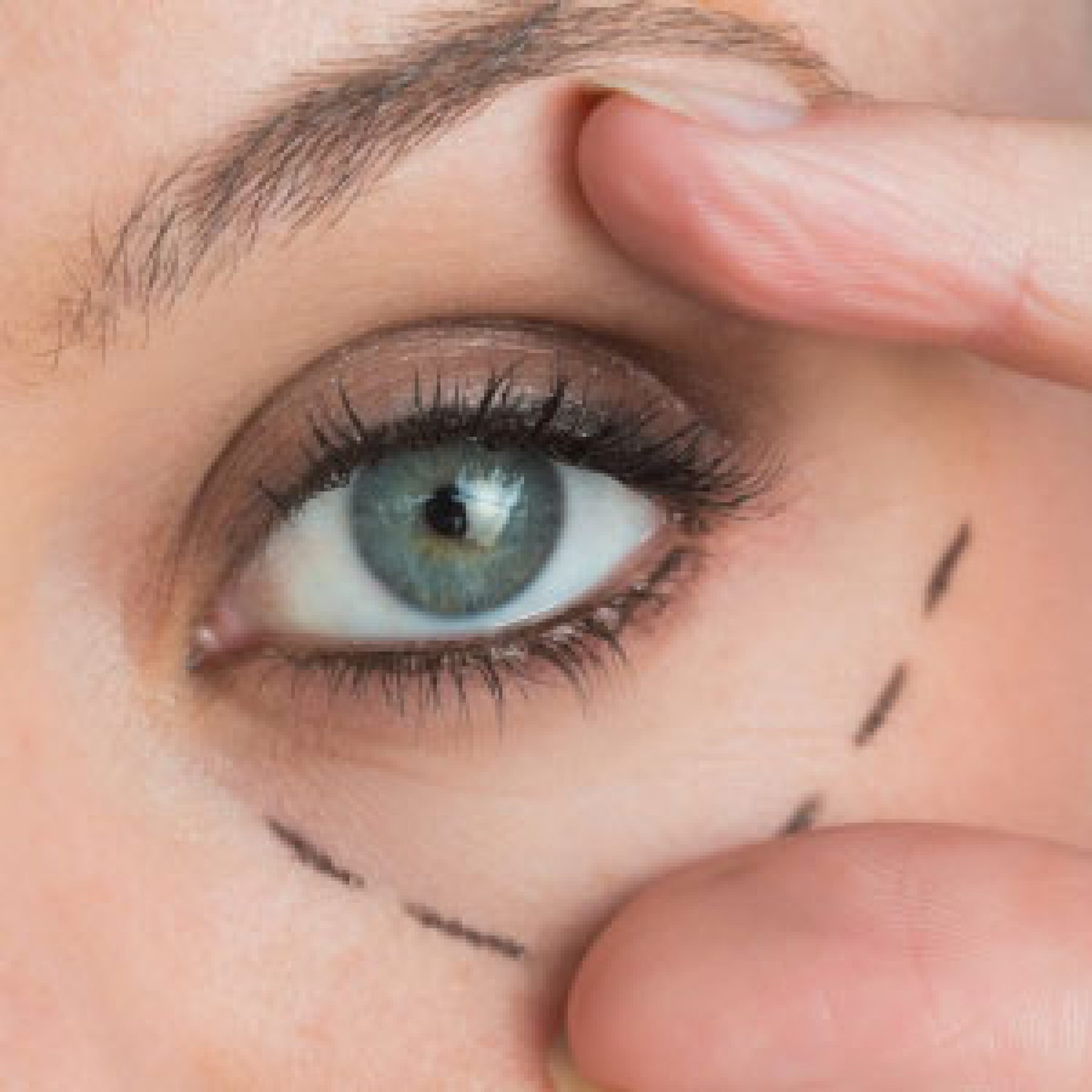 Augenklinik Bergman Clinics Medical EyeCare